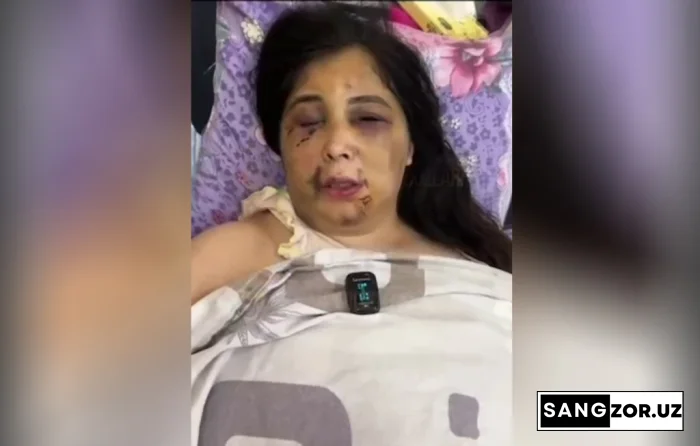 Тошкентда бир киши беш соат давомида собиқ хотинини вахшийларча калтаклаган