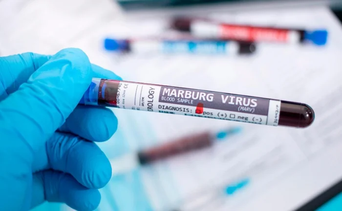 Қозоғистон Марбург безгаги кириб келиши хавфидан хавотирда