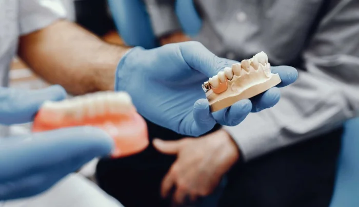 Ўзингизнинг тишингиздек ҳис қилувчи имплантлар яратилади